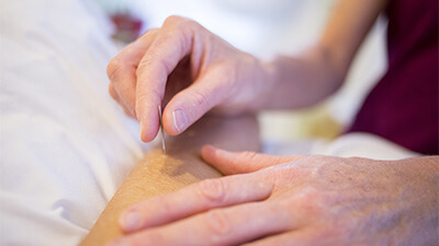 Acupuncture - London Natural Therapies