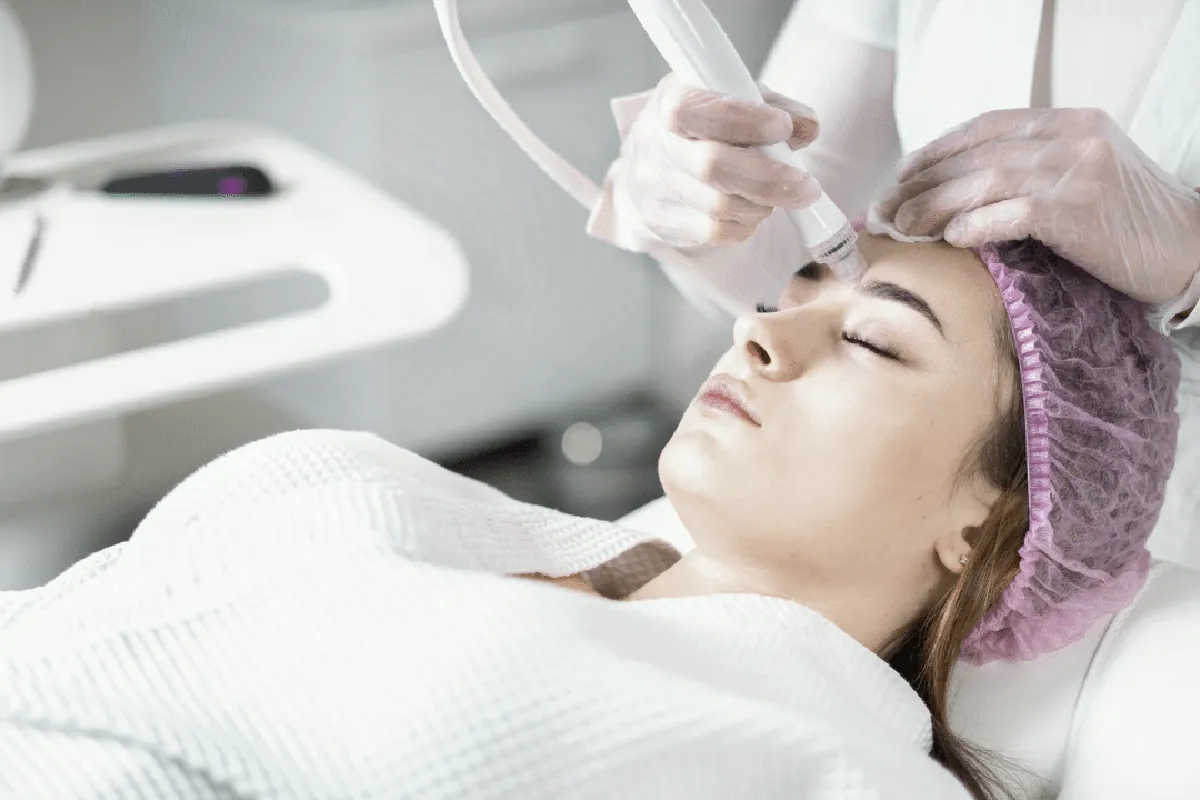 Dermapen microneedling device applied to the forehead