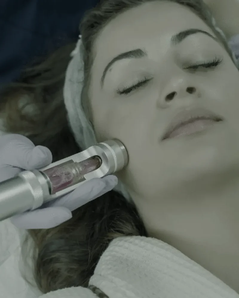 Client receiving a facial exosome treatment with a cooling device